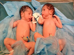 Coronavirus Positive Woman Delivers Healthy Twin Girls At Hyderabad Hospital Coronavirus Positive Woman Delivers Healthy Twin Girls At Hyderabad Hospital