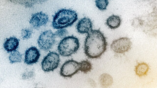 Coronavirus variants: B.1.1.7 and B.1.351 variants have been found to have increased transmissibility