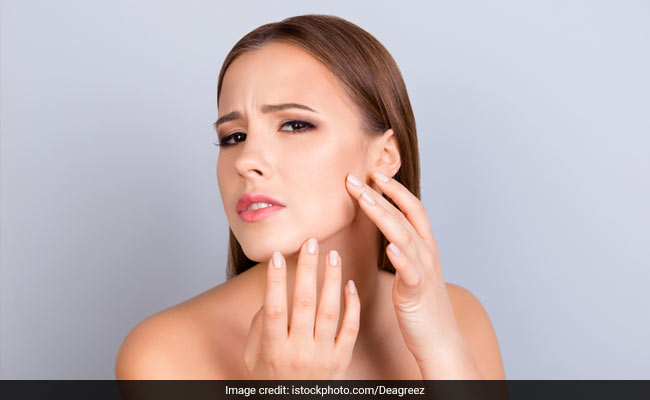 10 Commonly Asked Questions About Sensitive Skin