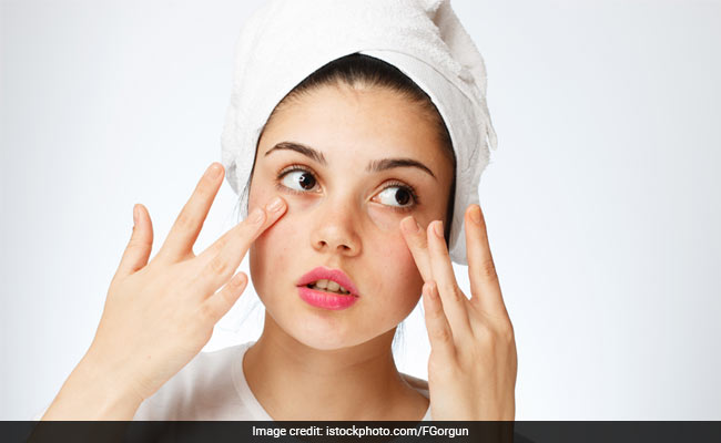 What Are The Causes Of Dark Circles? How To Prevent This Skin Problem?