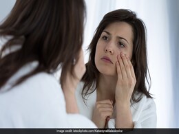 Home Remedies For Dark Circles: 10 Expert Tips To Light Up Your Under Eye Area Home Remedies For Dark Circles: 10 Expert Tips To Light Up Your Under Eye Area