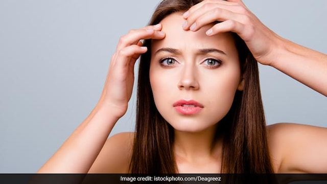 Acne can happen at any age, says celeb dermatologist Dr Jaishree Sharad