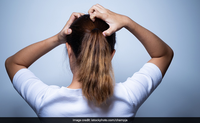 How to Get Rid Of Lice: Home Remedies, Prevention And Hair Care Treatments To Try