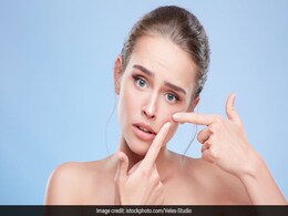 मानसून में किन कारणों से होते हैं मुंहासे, यहां जानें कैसे पा सकते हैं इनसे आसानी से छुटकारा मानसून में किन कारणों से होते हैं मुंहासे, यहां जानें कैसे पा सकते हैं इनसे आसानी से छुटकारा