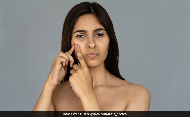 How To Hide Pimple Marks With Makeup In Hindi Saubhaya Makeup