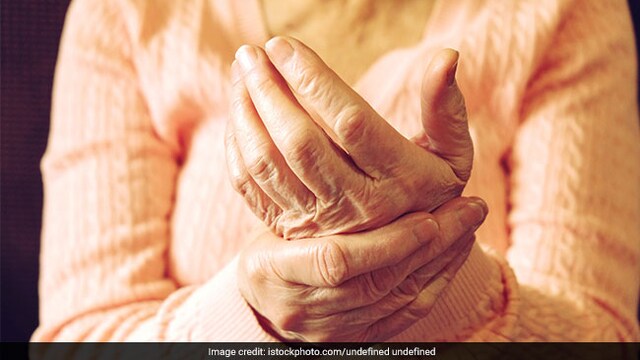 World Arthritis Day: Arthritis patients need to consume a well-balanced and healthy diet