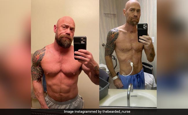 Coronavirus Survivor Shares Shocking Body Transformation Pics