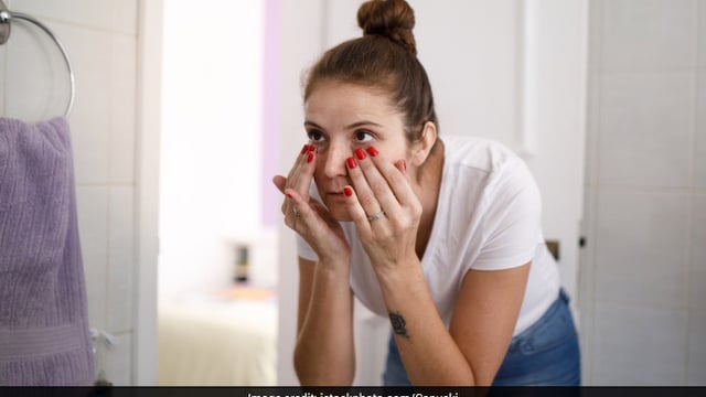 Several medical conditions can lead to dark circles
