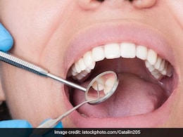 Oral Hygiene को रखना है मेंटेन तो करें ये उपाय, दांत हमेशा रहेंगे मजबूत, सफेद और चमकदार Oral Hygiene को रखना है मेंटेन तो करें ये उपाय, दांत हमेशा रहेंगे मजबूत, सफेद और चमकदार