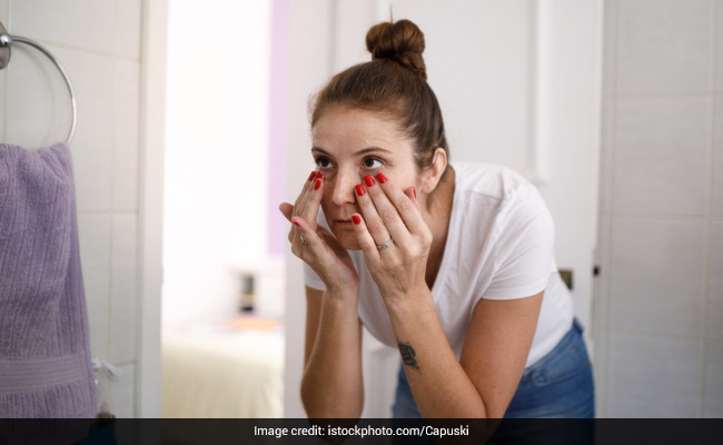 dark circles home remedies : आंखों के नीचे आ रहे डार्क सर्कल्‍स से हैं परेशान ? इन घरेलू नुस्‍खों से झटपट हो जाएंगे दूर