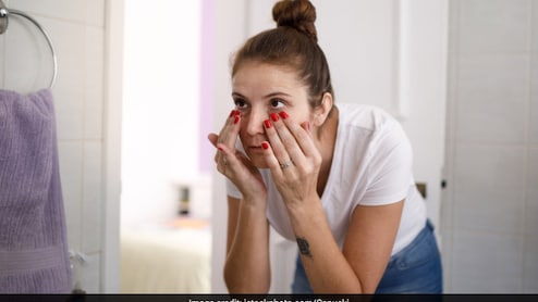 Nutritionist Lists 3 Types Of Dark Circles And Diet Hacks To Deal With Them