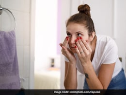 Nutritionist Lists 3 Types Of Dark Circles And Diet Hacks To Deal With Them Nutritionist Lists 3 Types Of Dark Circles And Diet Hacks To Deal With Them