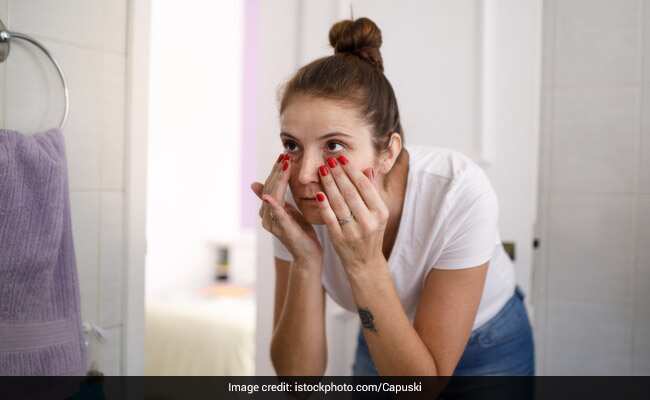 Skin Care Tips: जिद्दी डार्क सर्कल्स से तुरंत छुटकारा पाने के लिए कुछ अद्भुत घरेलू उपचार