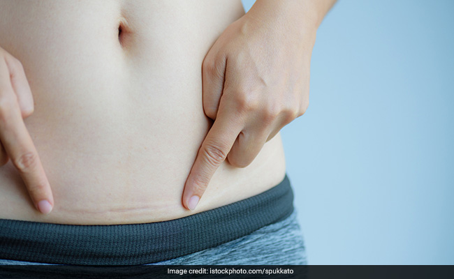 5 Things That Help Recovering From C-Section Delivery