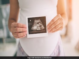 What Is The Best Position Of The Baby In The Mother's Womb During Childbirth? What Is The Best Position Of The Baby In The Mother's Womb During Childbirth?
