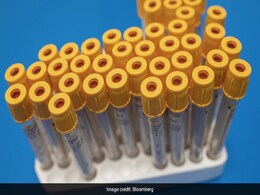 "Wanted To Be Part Of Fight Against COVID-19": Vaccine Trial Volunteer "Wanted To Be Part Of Fight Against COVID-19": Vaccine Trial Volunteer