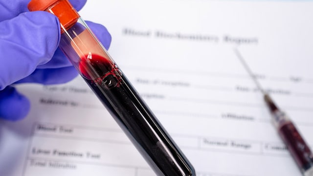 Plasma therapy can be helpful for those are critically ill with coronavirus