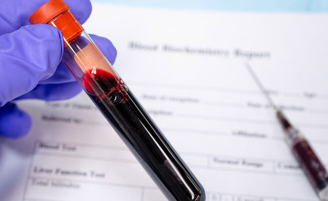 Plasma therapy can be helpful for those are critically ill with coronavirus