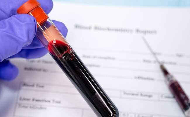 Plasma Therapy For COVID-19: Know Who Can And Cannot Donate Plasma