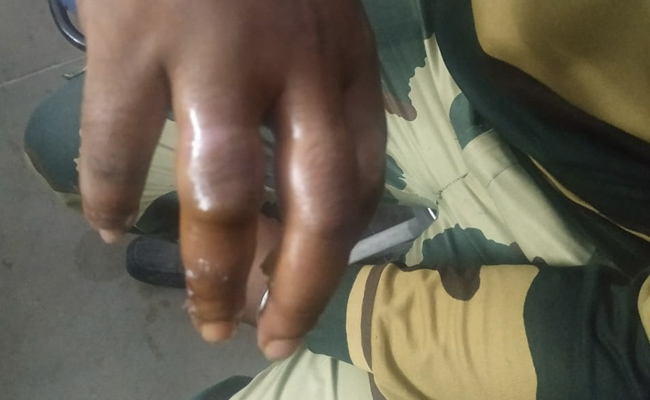 घायल और अकेले BSF जवान का सामना नहीं कर पाए तस्कर, मवेशियों को छोड़कर भागे