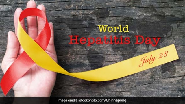 Hepatitis refers to the inflammation of the liver caused by hepatitis viruses
