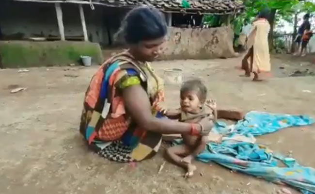 मध्य प्रदेश: लॉकडाउन का सबसे बुरा असर बच्चों और गर्भवती महिलाओं पर, लगभग 12 लाख बच्चे कुपोषण की चपेट में