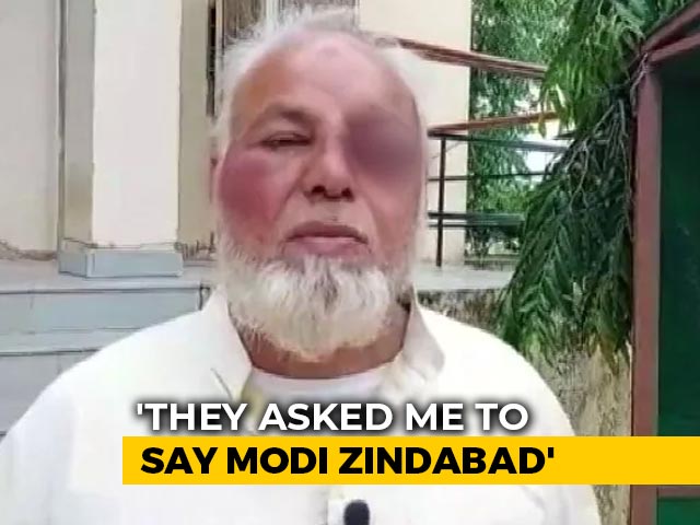 Beaten For Not Chanting "Jai Shri Ram", "Modi Zindabad": Rajasthan Driver