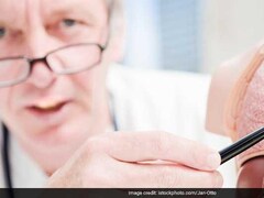 Understanding the Stages of Prostate Cancer: What Every Man Should Know