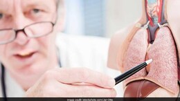 Understanding the Stages of Prostate Cancer: What Every Man Should Know