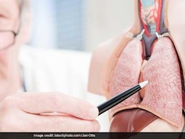 Research And Development In Lung Cancer Research And Development In Lung Cancer