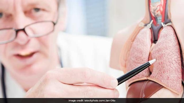 World Lung Cancer Day 2021: Air pollution is one of the major risk factors for lung cancer