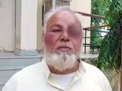 জয় শ্রী রাম না বলার অপরাধে লাঠিপেটা সংখ্যালঘু অটো চালককে! উপড়ানো হলো দাড়িও