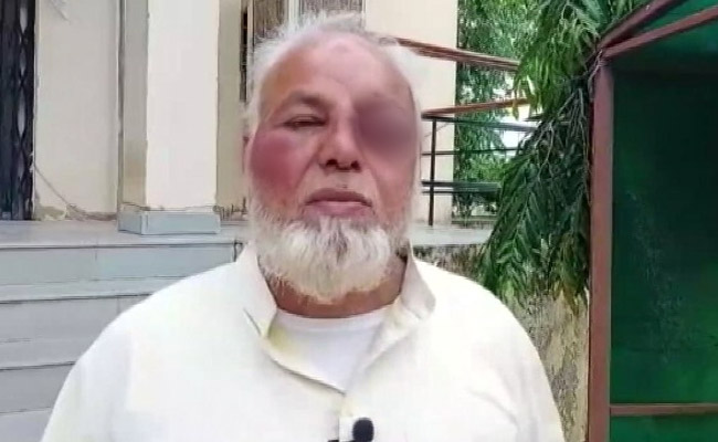 Beaten For Not Chanting <i>"Jai Shri Ram", "Modi Zindabad"</i>: Rajasthan Driver
