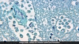 Scientists Warn Of Increasing Public Health Risks From Free-Living Amoebae