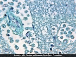 Scientists Warn Of Increasing Public Health Risks From Free-Living Amoebae