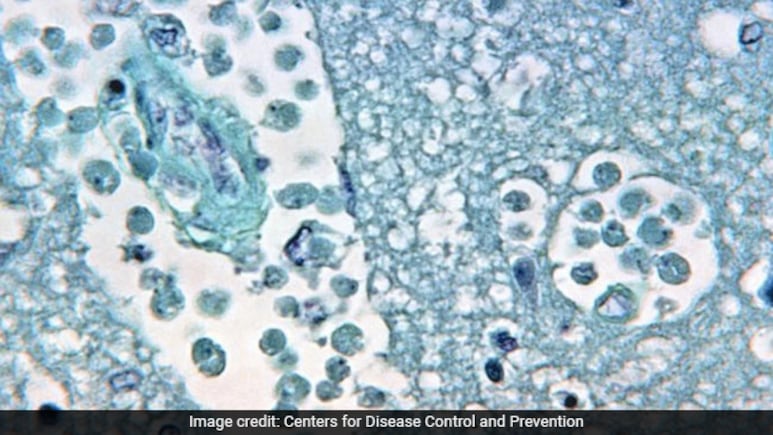Scientists Warn Of Increasing Public Health Risks From Free-Living Amoebae