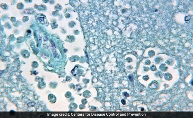 Scientists Warn Of Increasing Public Health Risks From Free-Living Amoebae