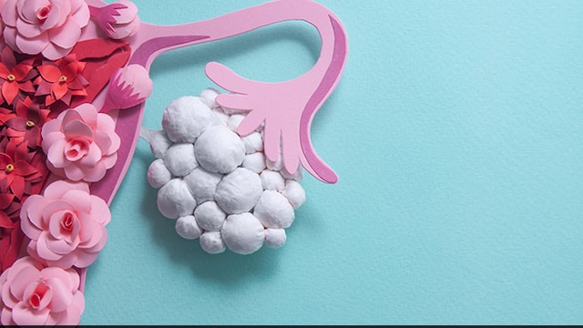 World Ovarian Cancer Day: This cancer is often referred as a silent killer