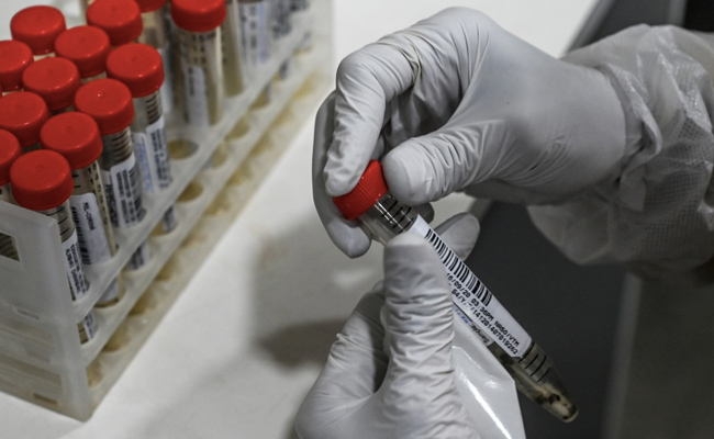 कोविड-19 संक्रमण का पता लगाने के लिए ज्यादा कारगर रैपिड जांच विकसित