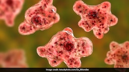 US Man Dies From Rare Brain-Eating Amoeba Infection After Water Skiing