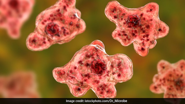 Brain-Eating Amoeba: You are advised to follow these preventive measures to avoid it