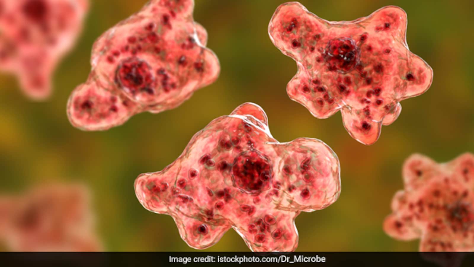 Genrix Face Brain-Eating Amoeba Kills Pak Man After He Went Swimming: Report