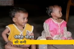 लॉकडाउन से पालघर में बढ़ा बच्चों में कुपोषण लॉकडाउन से पालघर में बढ़ा बच्चों में कुपोषण