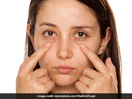 Say Goodbye To Dark Circles! Try These 5 Expert-Approved Home Remedies To Tackle Them Say Goodbye To Dark Circles! Try These 5 Expert-Approved Home Remedies To Tackle Them
