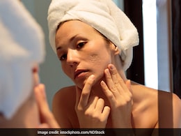 Skincare Tips: Struggling With Acne Scars? Heres What Can Help Skincare Tips: Struggling With Acne Scars? Heres What Can Help