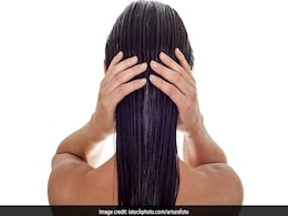 10 Top-Rated Onion Hair Oils To Control Hair Fall Control And Promote Hair Growth 10 Top-Rated Onion Hair Oils To Control Hair Fall Control And Promote Hair Growth