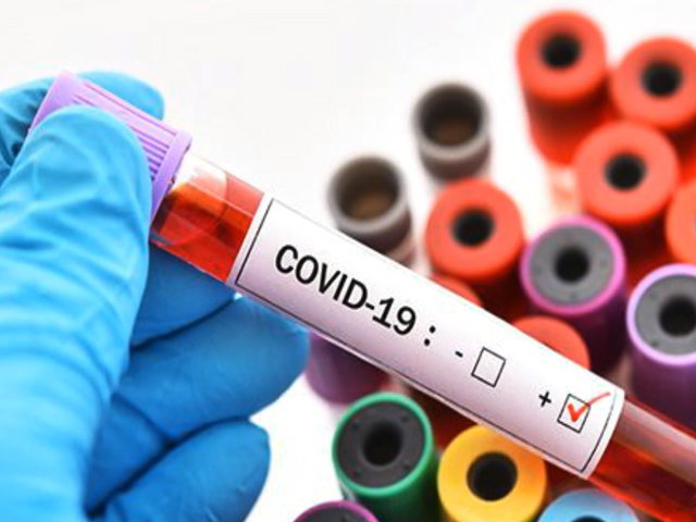 Five Myths About COVID-19 Testing Debunked