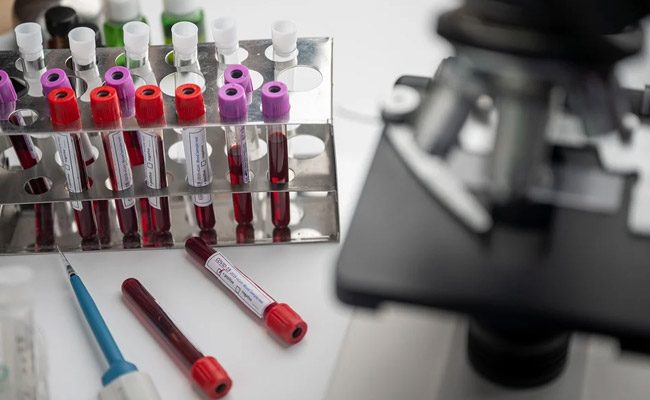 Oxford Coronavirus Vaccine Could Be Rolled Out Within Six Months: Report