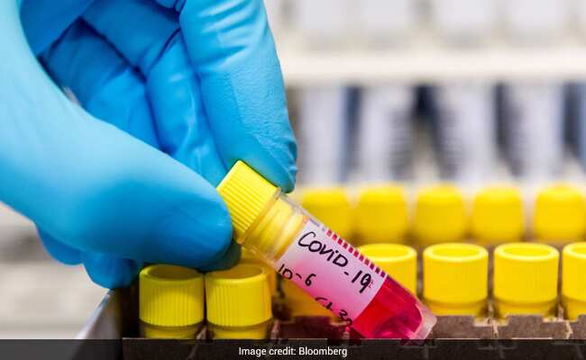 Telangana COVID-19 Cases Today: तेलंगाना में 1,432 नये मामले, आठ और मौत, अब तक 1,249 मौतें