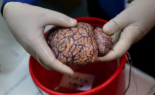 Scientists Create New Tech That Can Read People's Mind With Shocking Accuracy